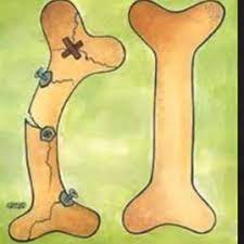 خواص ماش برای پوکی استخوان