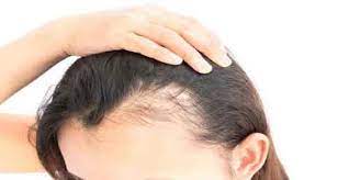 خواص آویشن برای مو