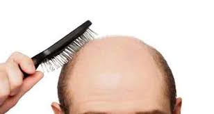 خواص آویشن برای درمان ریزش مو 
