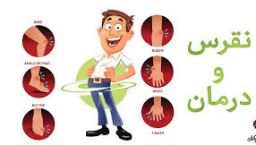 خواص بابا آدم برای نقرس